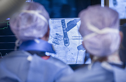 CARDIOVASCULAR INTERVENTION